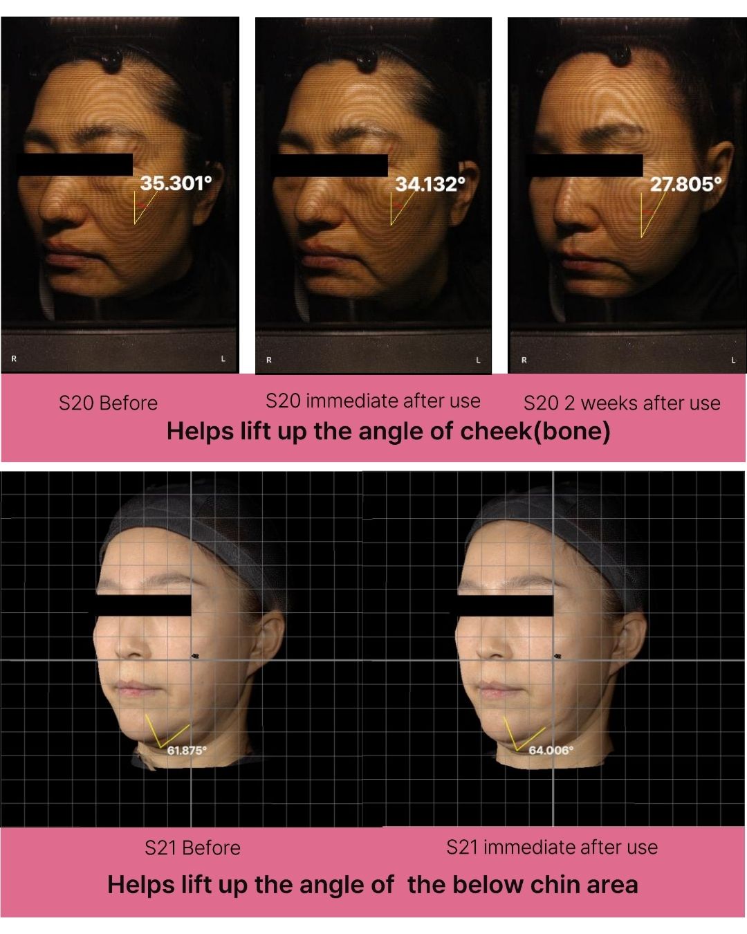 Lavien Collagen Ampoule Program