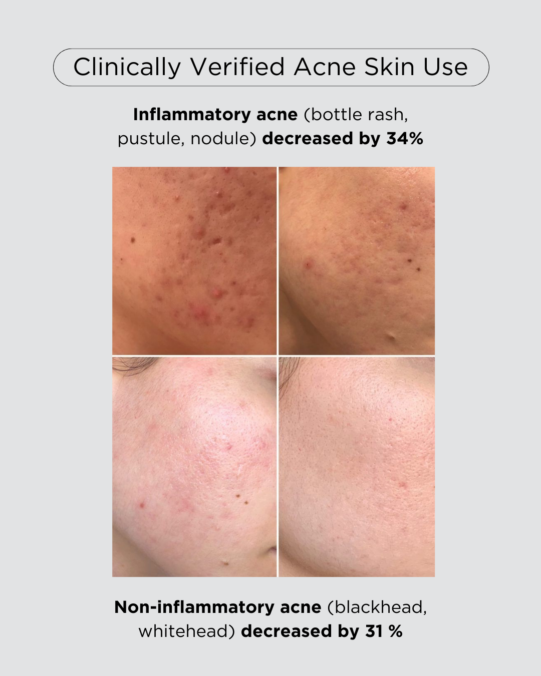 PINKWONDER Tamanu Hero Ampoule