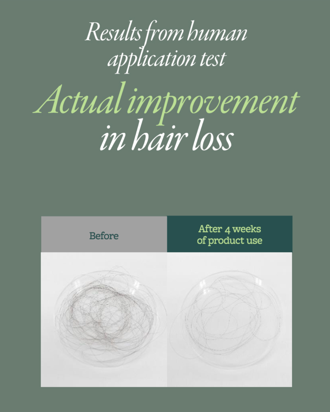 Mintree Sparkling Scalp Scaler (Upgraded)