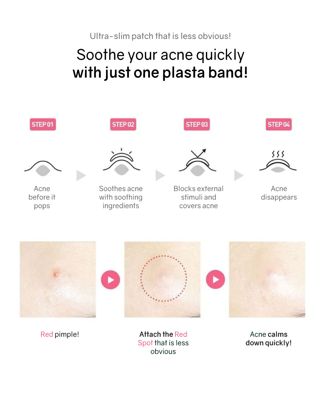 Hatherine Spot Care Patch Red Spot (40 patch)