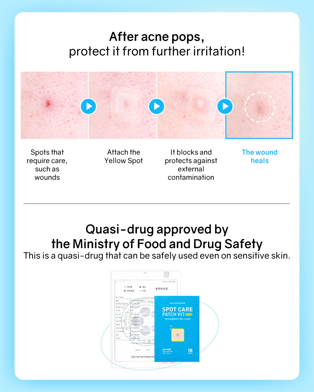 Hatherine Spot Care Patch Kit (76 patch)