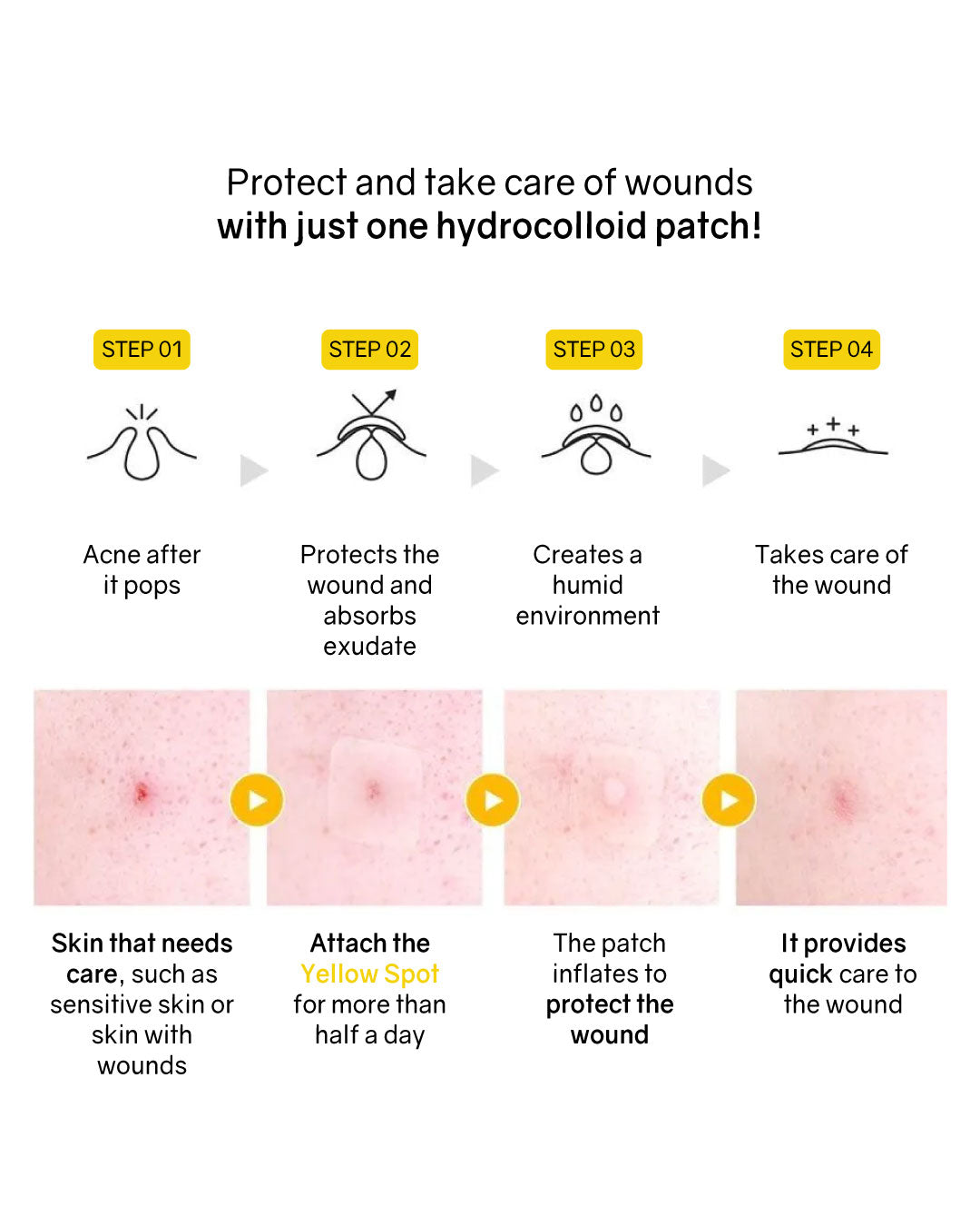 Hatherine Spot Care Patch Yellow Spot (20 patch)