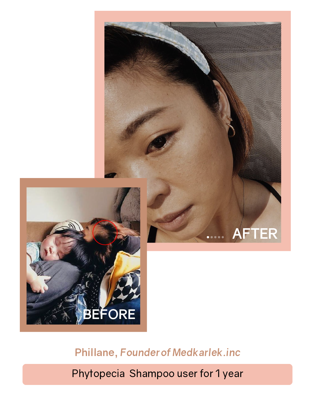 Phytopecia+ Hair Boosting Series