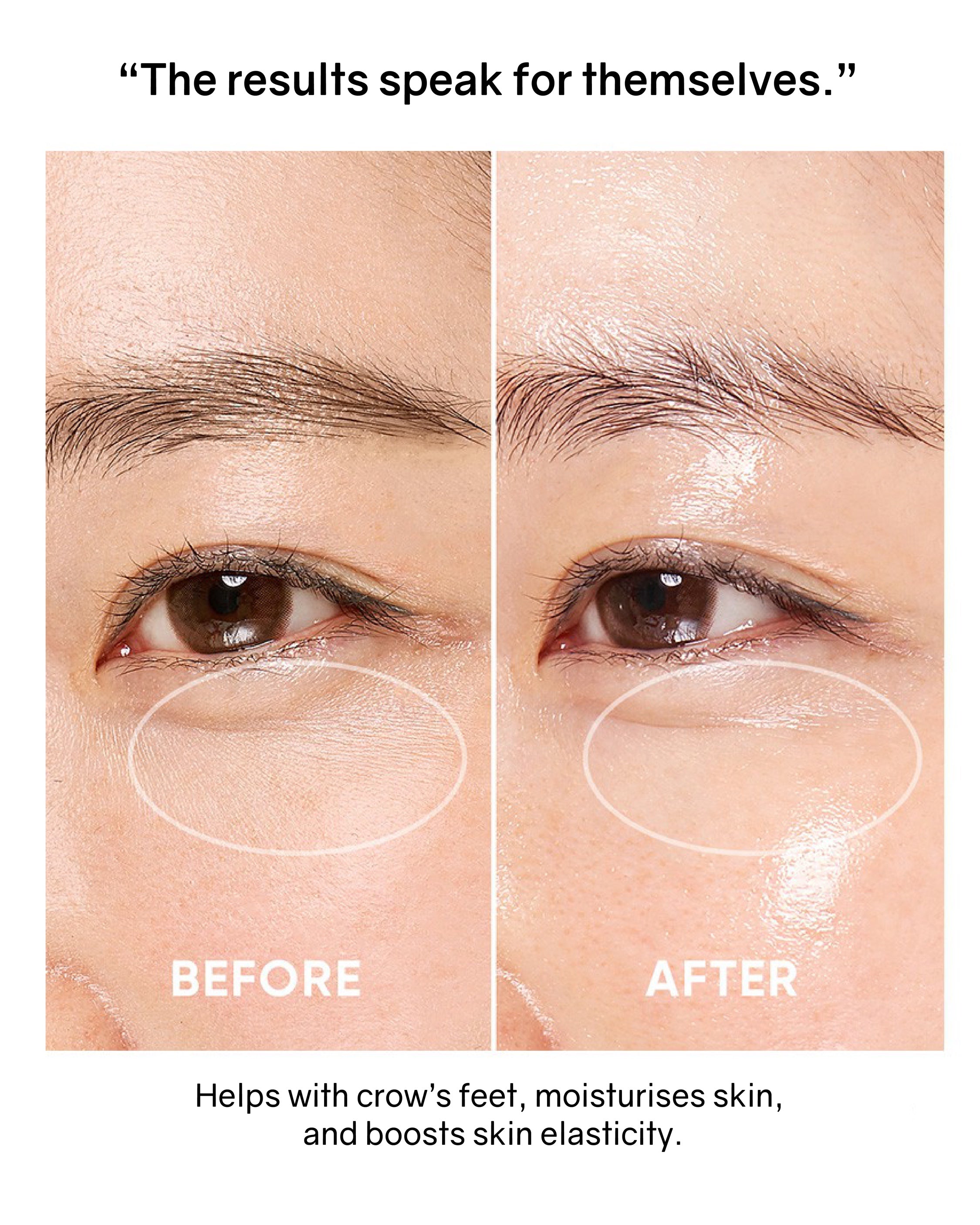 OHIOHOO Pro Collagen Lift Kit