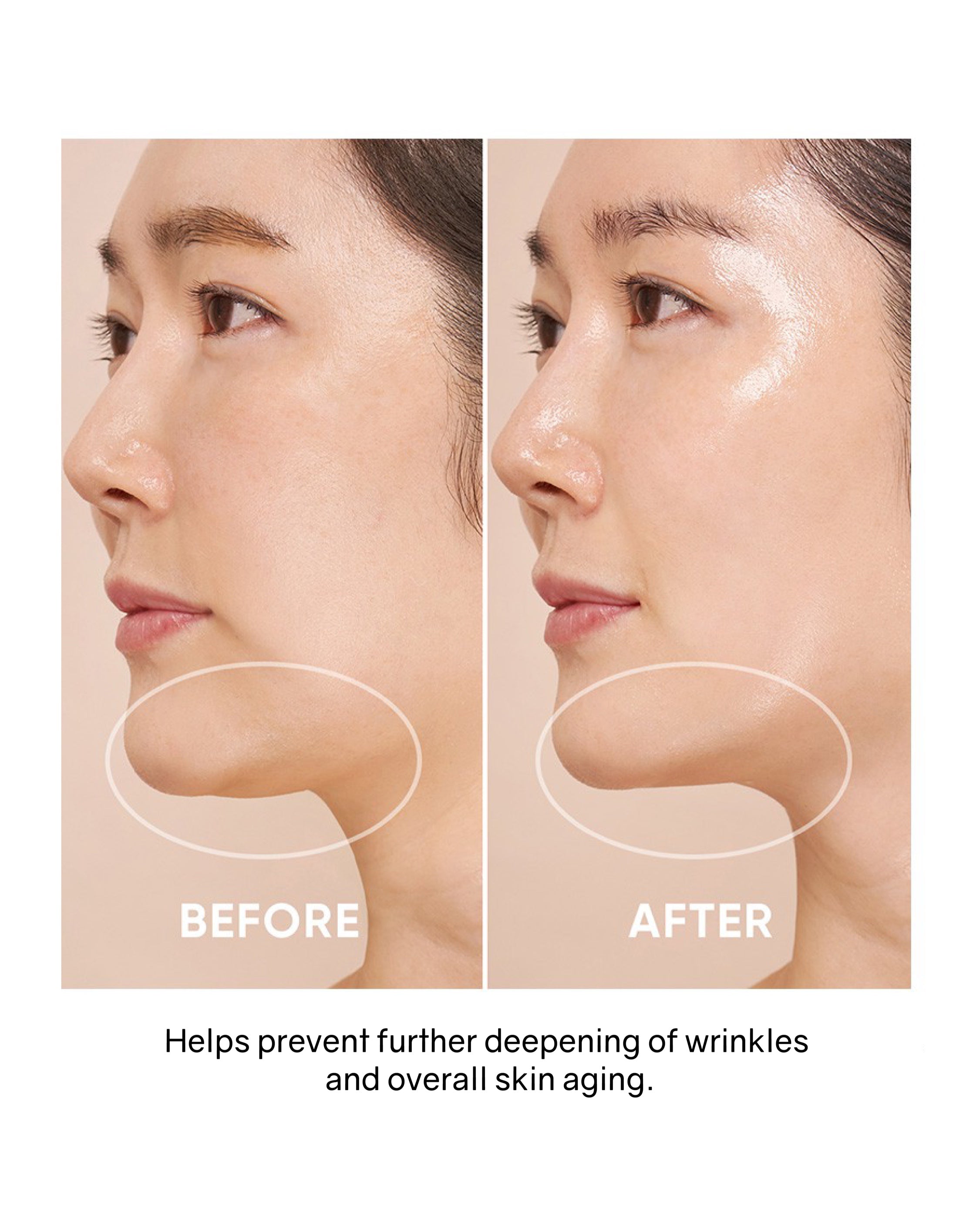 OHIOHOO Pro Collagen Lift Kit