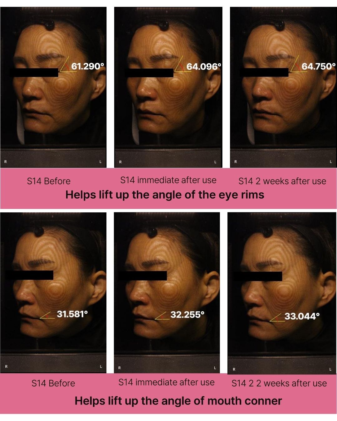 [Online Exclusive] Lavien Collagen Ampoule Program