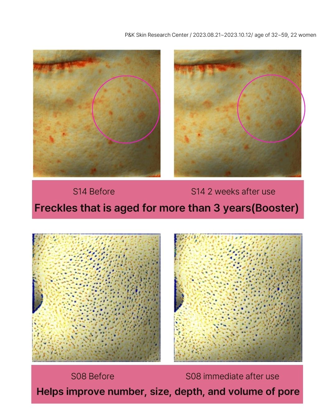 [Online Exclusive] Lavien Collagen Ampoule Program
