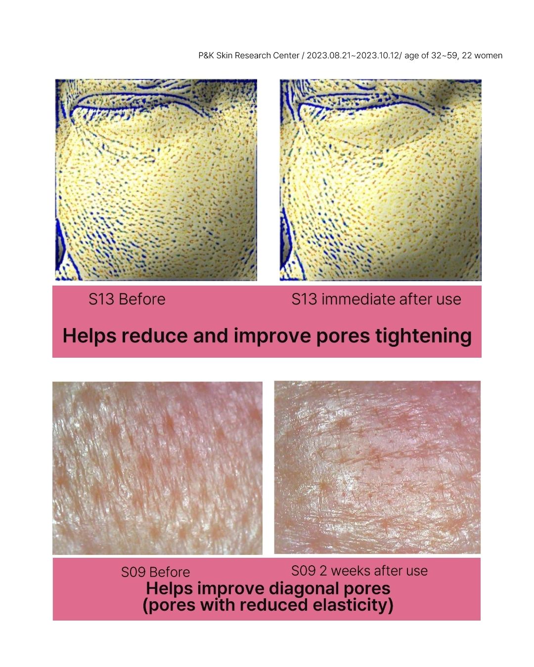 [Online Exclusive] Lavien Collagen Ampoule Program