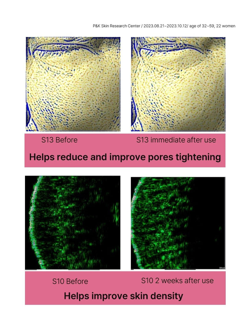 Lavien Collagen Ampoule Program