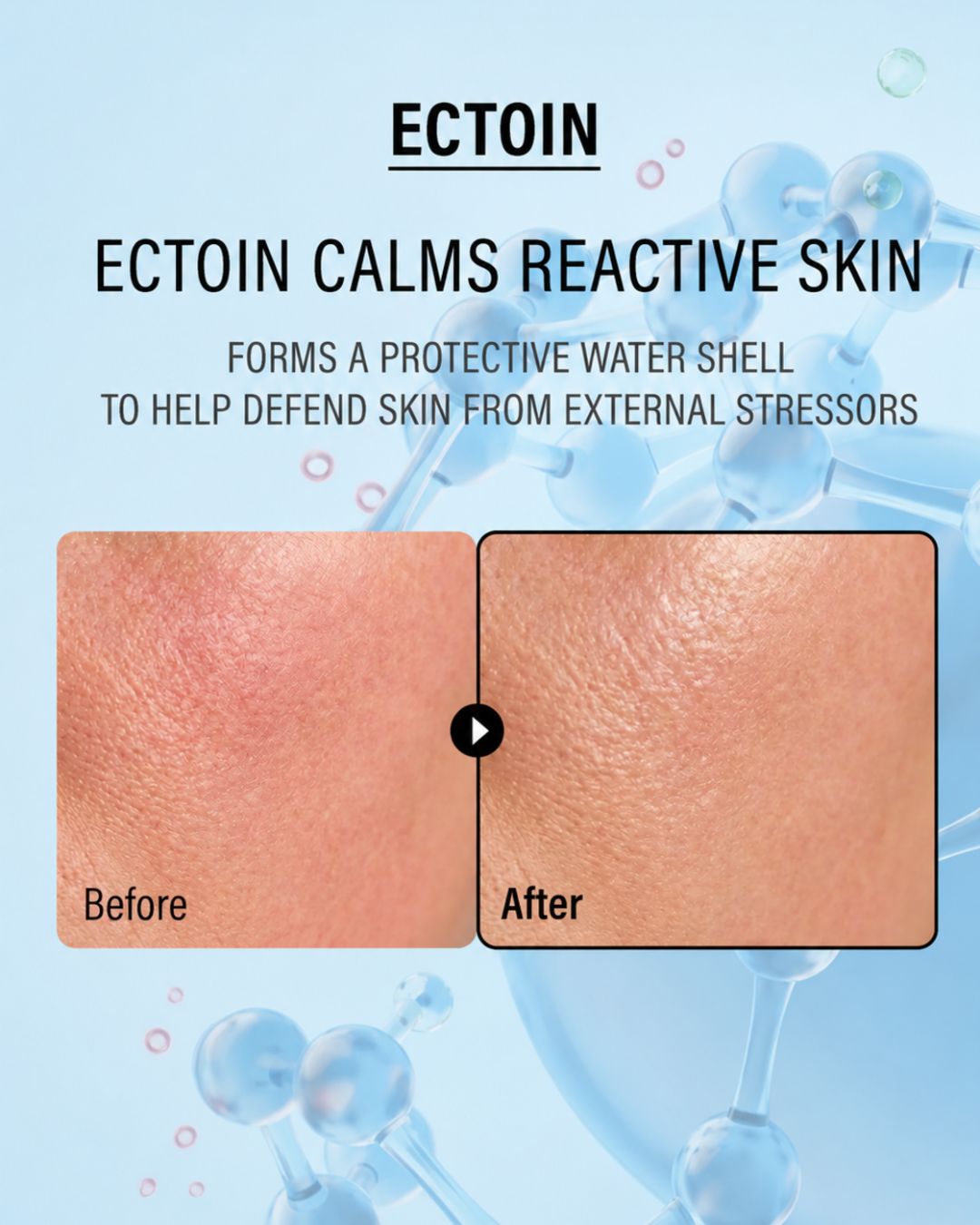 [PROMO] EPII Skincare Kits