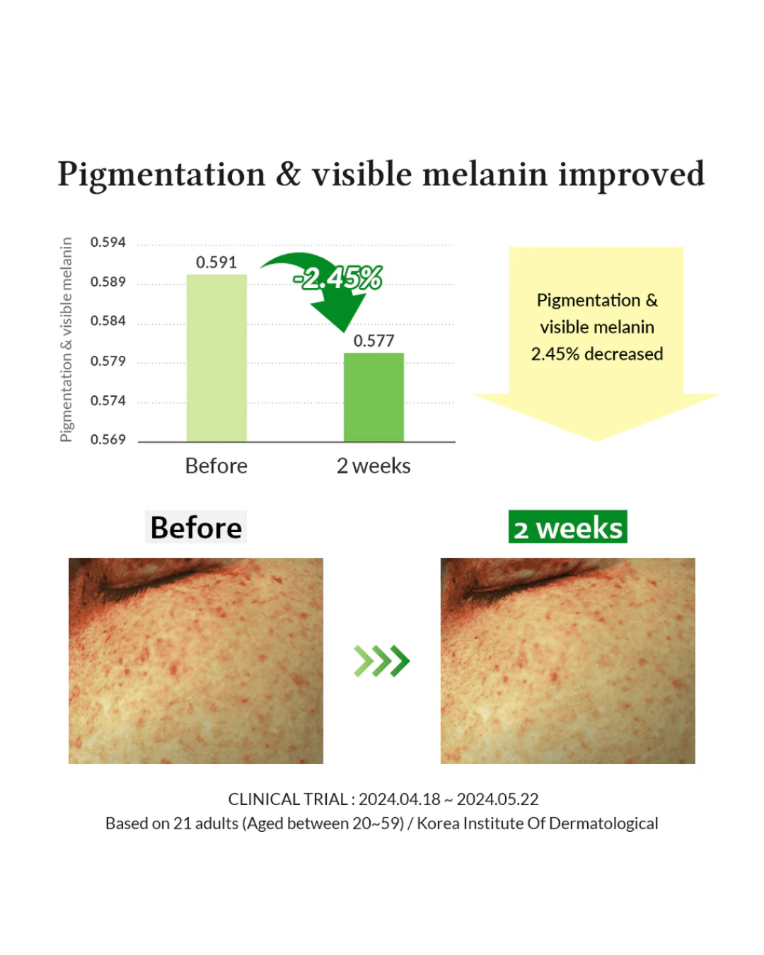 Dr. Althea Gentle Vitamin C Serum (30ml)
