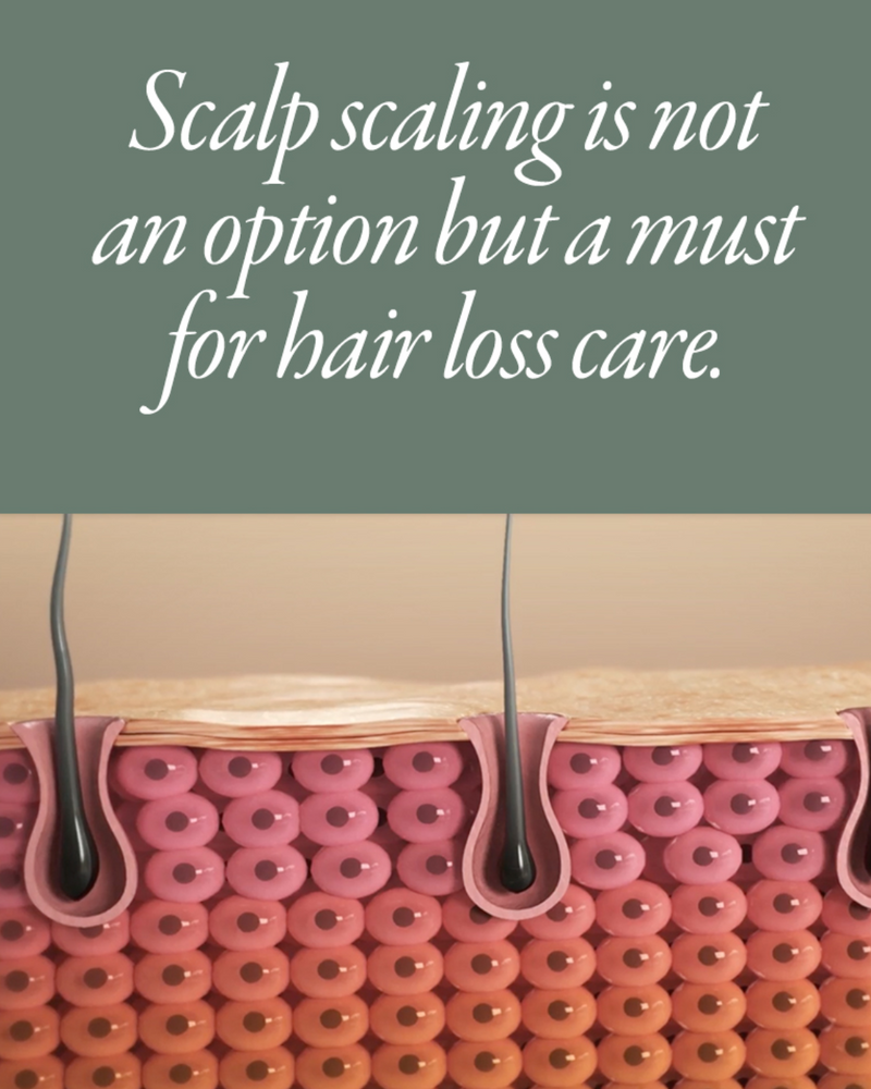 Mintree Sparkling Scalp Scaler (Upgraded)