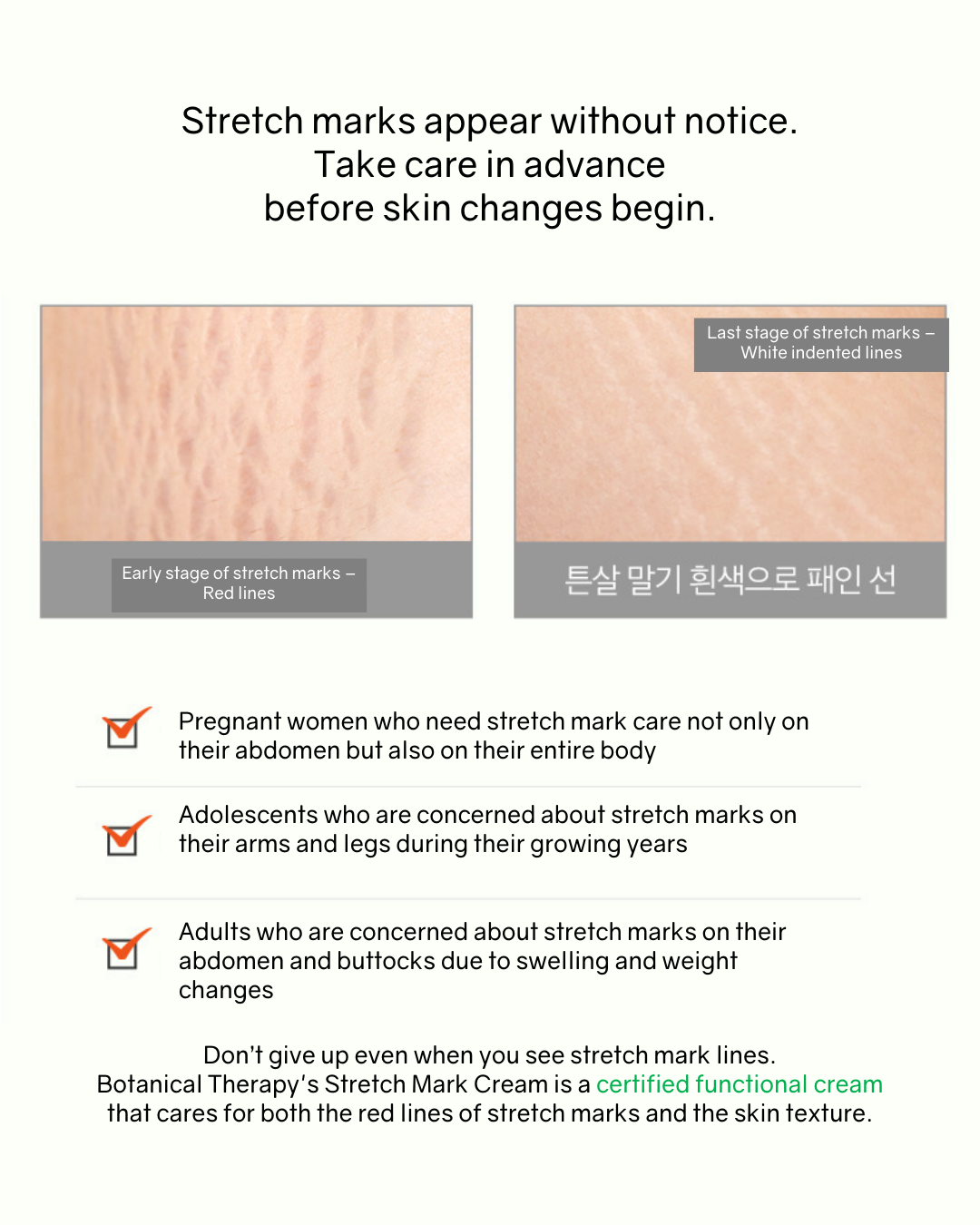 [PROMO] Botanical Therapy Stretch Cream