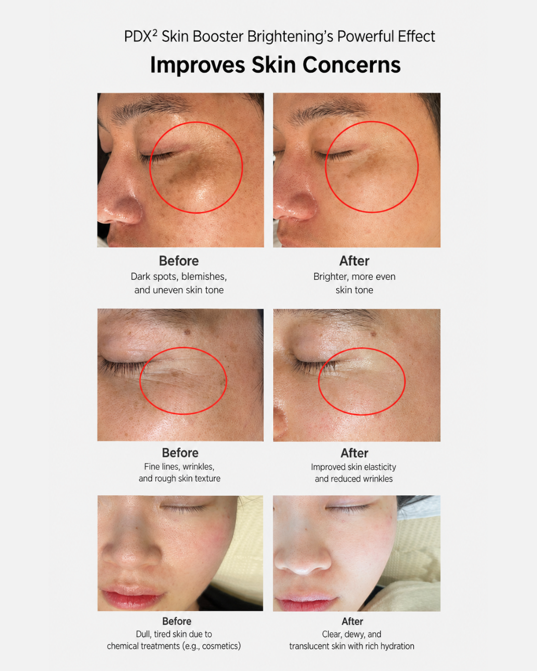 [PROMO] Dermaline Booster Ampoules (PDX5/PDX2)