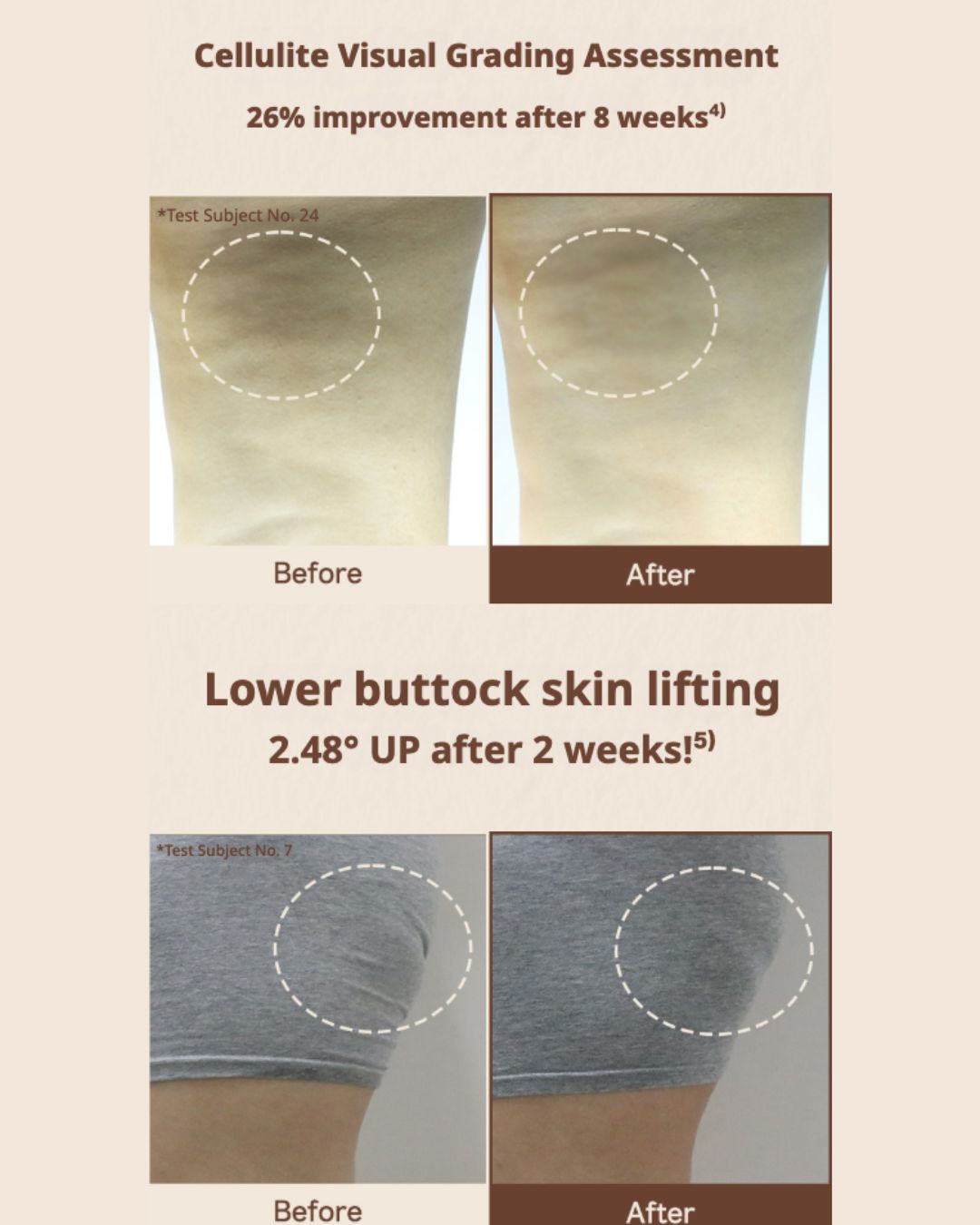 [PREORDER] nutseline Aroma Nut Slim Fit Body Guasha Serum (60ml) (Dispatch Date: 18-22 May)