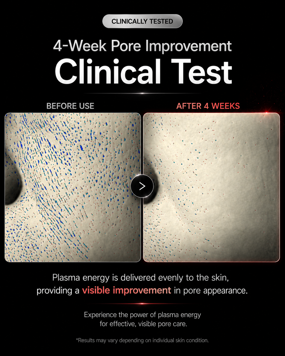 [PREORDER] Returnity Skin Healer Plasma Device (Dispatch Date: 28 Sep - 2 Oct)