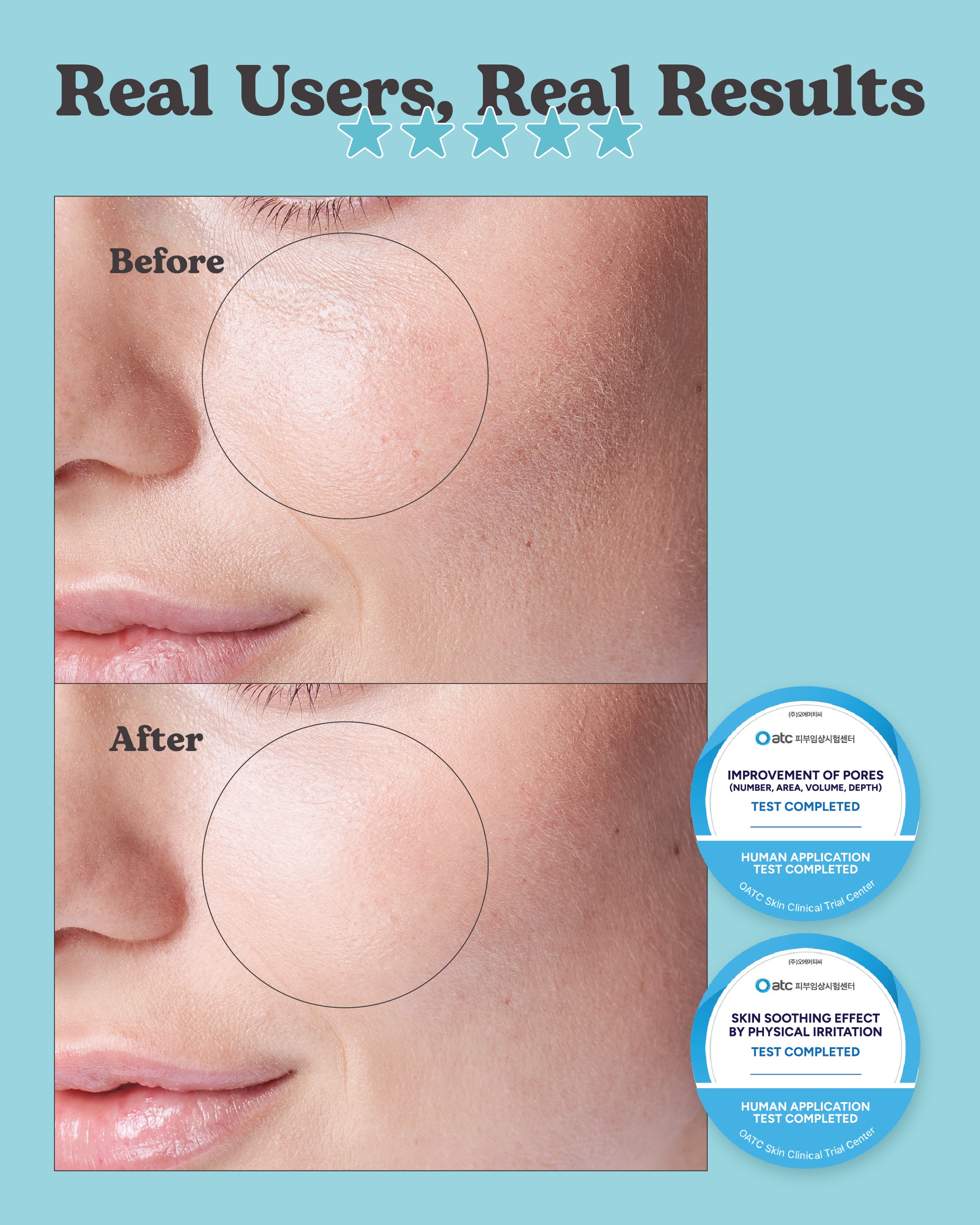 [PROMO] Jung Beauty CO2 Pore Deep Cleansing Mask For Face & Neck