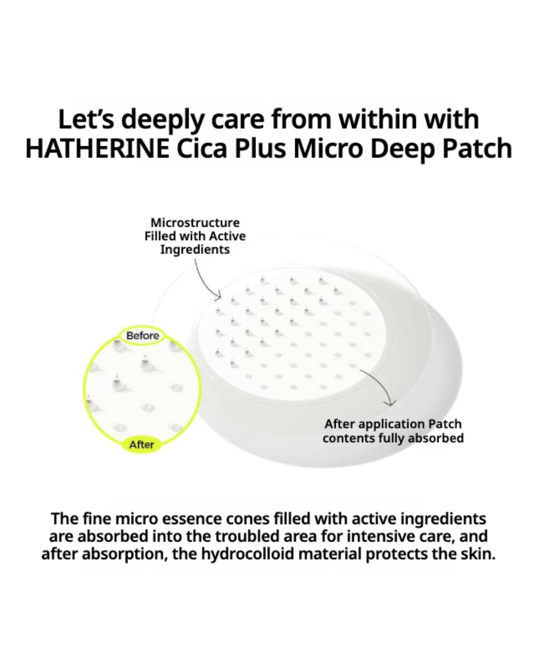 [PROMO] Hatherine Cica + Micro Deep Patch (9 patches) (NEW!)