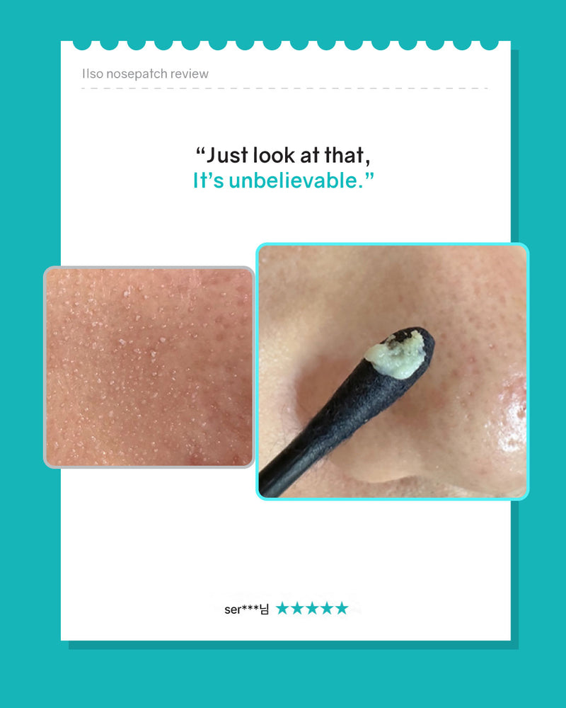 ilso Natural Mild Clear Nose Patch (5ea)