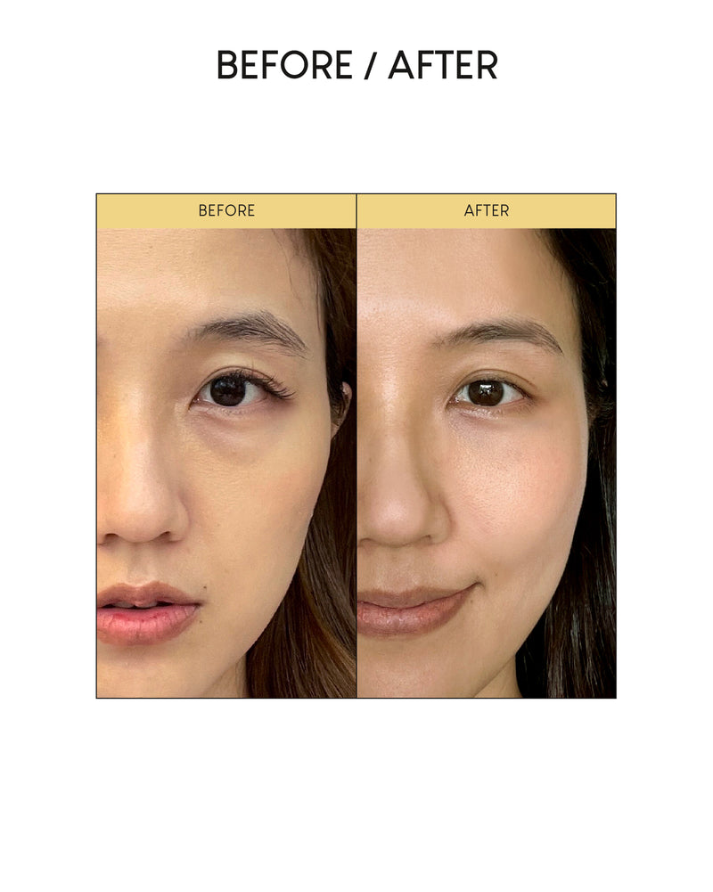 [PROMO] Jung Beauty Firming Microdart Eye Patch with Bakuchiol, Niacinamide and Peptides