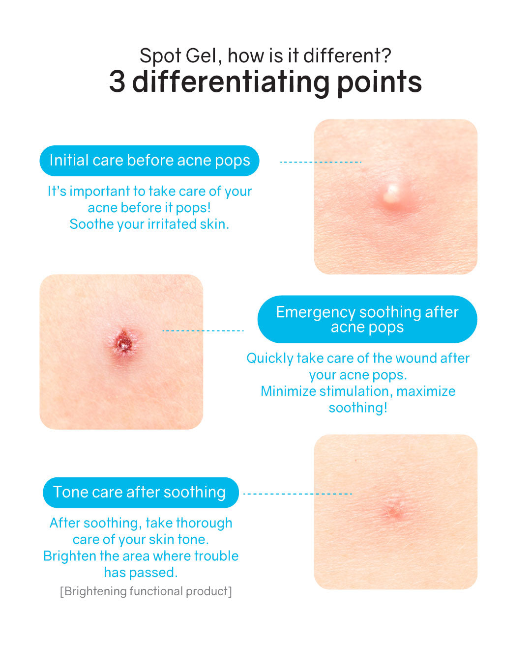 [PROMO] Hatherine Spot Care Clear Gel
