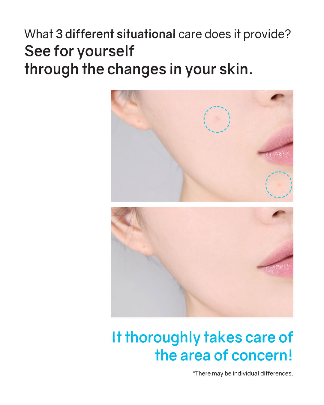 [PROMO] Hatherine Spot Care Clear Gel