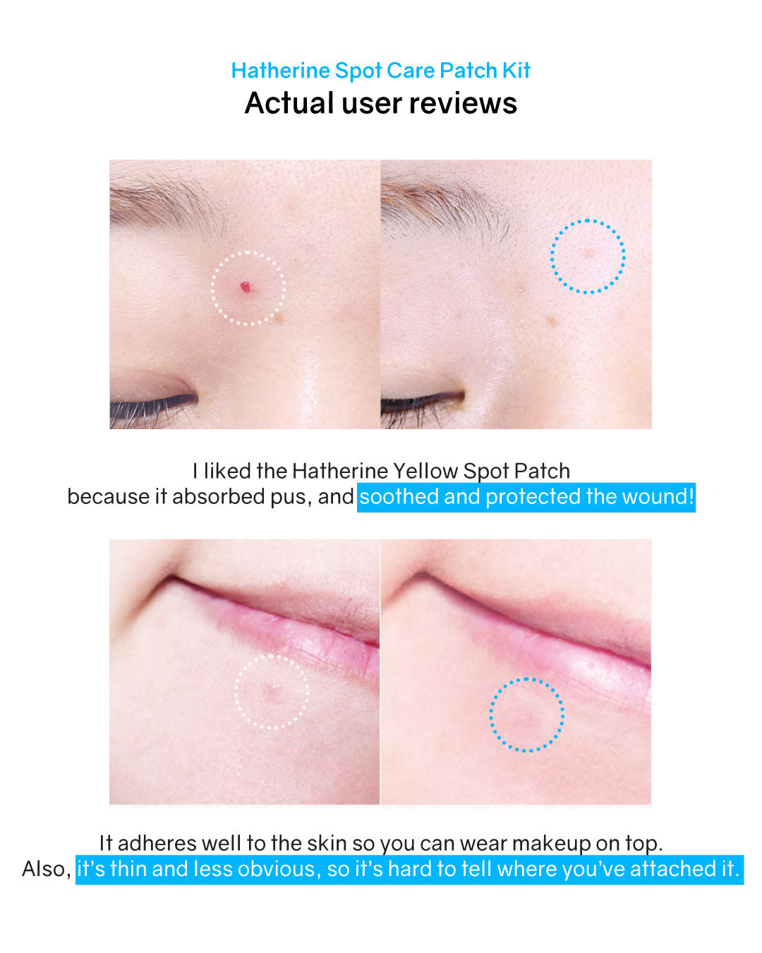 Hatherine Spot Care Patch Kit (76 patch)