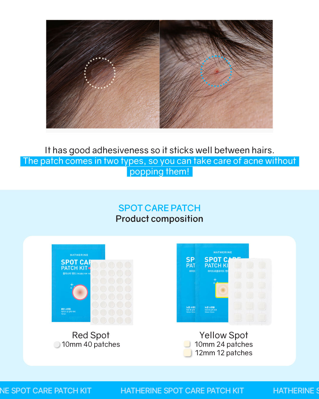 Hatherine Spot Care Patch Kit (76 patch)