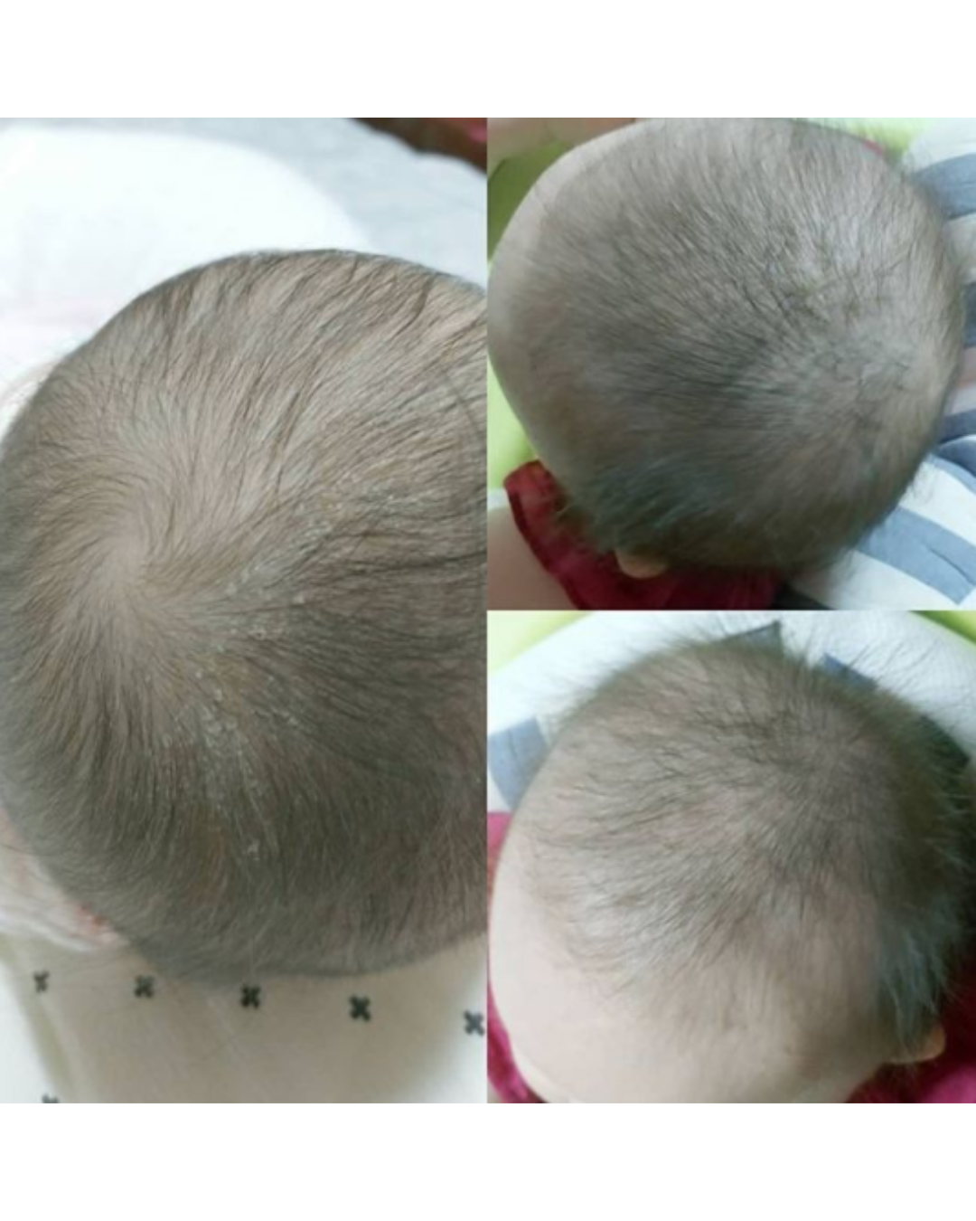 [PROMO] Botanical Therapy Cleansing Therapy Pure Baby Shampoo