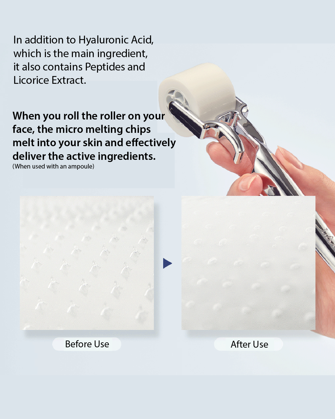 Lavien 4000 Micro Shot Skin Roller